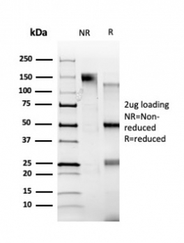 ZBTB39 Antibody / ZNF922 / KIAA0352