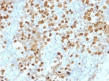 ZMYM3 Antibody