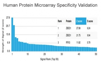 ZBED1 Antibody / DREF