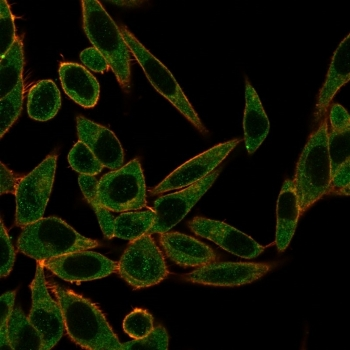 ZNF622 Antibody / ZPR9