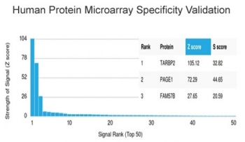 TARBP2 Antibody