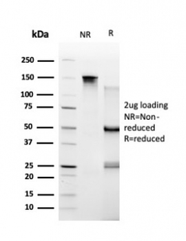 TARBP2 Antibody