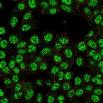 p65 Antibody / NF-kB