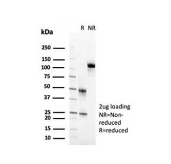 CD2 Antibody