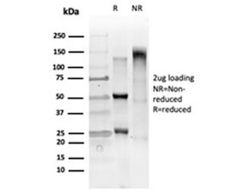 GTF2IRD2 Antibody / GTF2IRD2 alpha