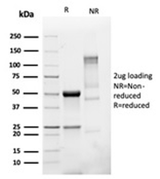 TMEPAI Antibody / PMEPA1