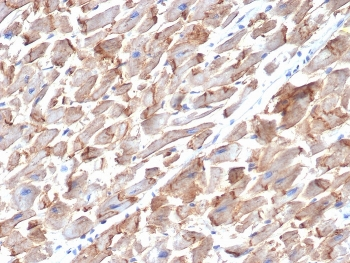 N-Cadherin Antibody / CDH2
