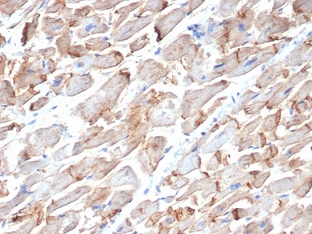 N-Cadherin Antibody / CDH2