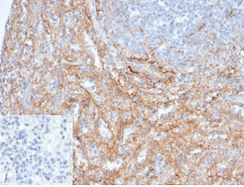 ICAM1 Antibody / CD54
