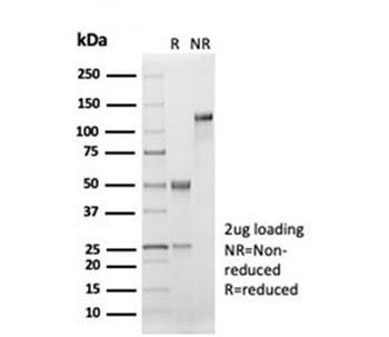 Recombinant CD33 Antibody