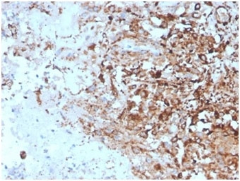 TIM-3 Antibody / HAVCR2