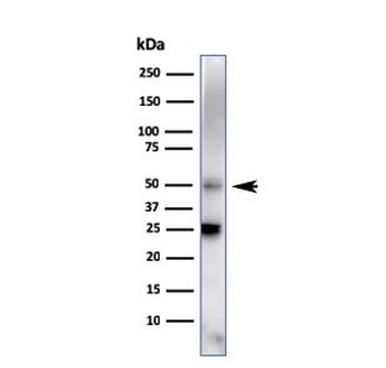 TIM-3 Antibody / HAVCR2