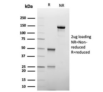 TIM-3 Antibody / HAVCR2
