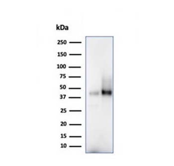 CD38 Antibody