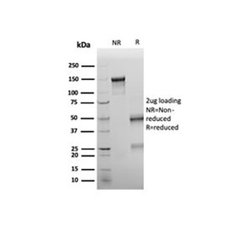 Recombinant WT1 Antibody / Wilms Tumor 1