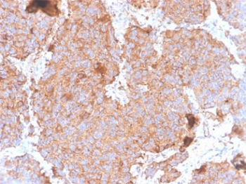 Prolactin Antibody / PRL