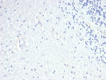 Prolactin Antibody / PRL