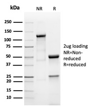 Prolactin Antibody / PRL