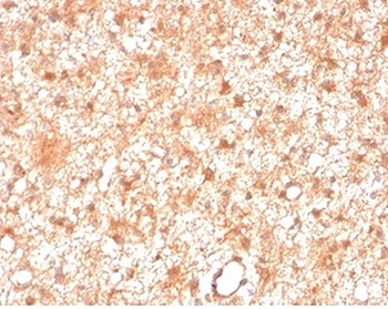 PKC iota Antibody / PRKCI