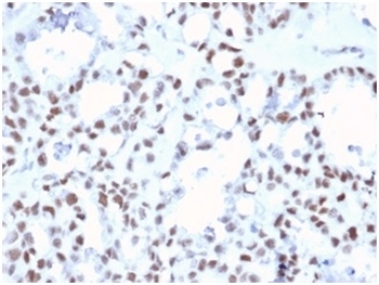 MLH1 Antibody / MutL Homolog 1