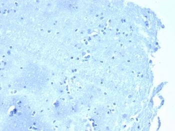 p120 Catenin Antibody / CTNND1 / Catenin delta 1