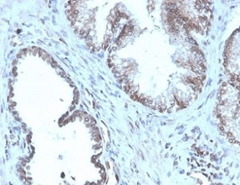 Prostein Antibody / SLC45A3