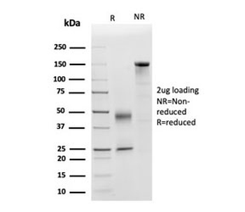 APOD Antibody / Apolipoprotein D