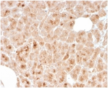 LMO2 Antibody / Rhombotin 2