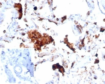 Recombinant Napsin A Antibody