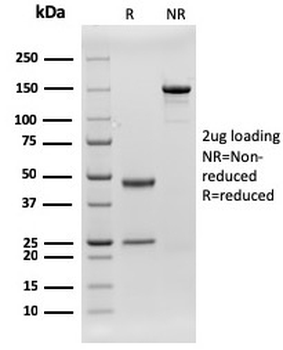 Recombinant CD79b Antibody