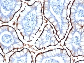 ACE2 Antibody / Angiotensin-Converting Enzyme 2