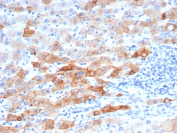 KRT8 Antibody / Cytokeratin 8