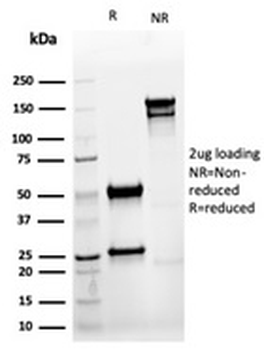 KRT8 Antibody / Cytokeratin 8