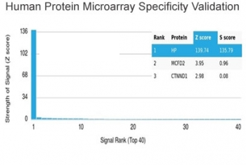 Haptoglobin Antibody