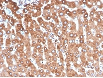 Haptoglobin Antibody
