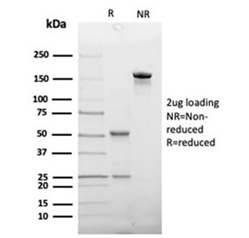 Haptoglobin Antibody