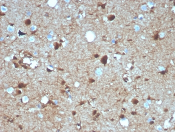 S100B Antibody