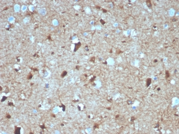 S100B Antibody