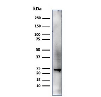 CBFB Antibody