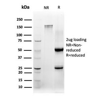 CBFB Antibody