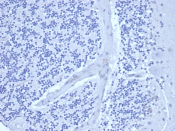 Ki-67 Antibody