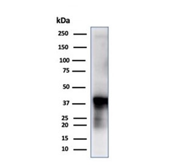 Glutamine Synthetase Antibody / GLUL