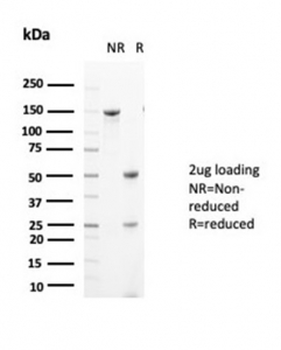 Glutamine Synthetase Antibody / GLUL