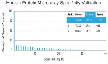 S100B Antibody