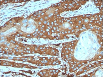 RPSA Antibody / 40S Ribosomal protein SA