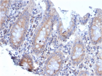 RPSA Antibody / 40S Ribosomal protein SA