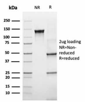 RPSA Antibody / 40S Ribosomal protein SA