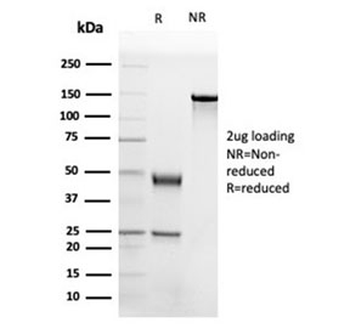APOB Antibody / Apolipoprotein B