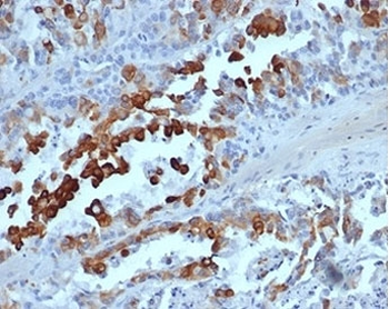 Cytokeratin 20 Antibody / CK20