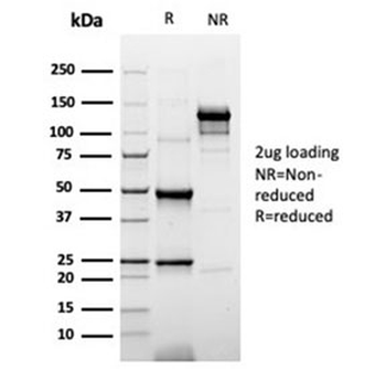 Cytokeratin 20 Antibody / CK20